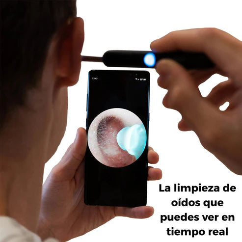 Dispositivo de Limpieza Auditiva - Cámara Integrada - Visualiza y elimina la cera en segundos.