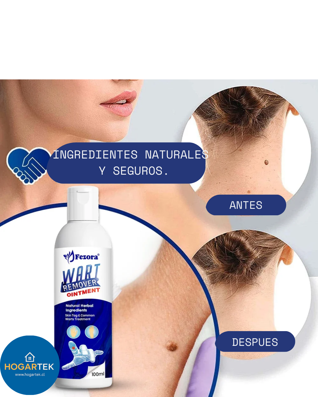 Crema Eliminadora de Verrugas y Fibromas - Tratamiento Efectivo - Resultados visibles en solo 7 días