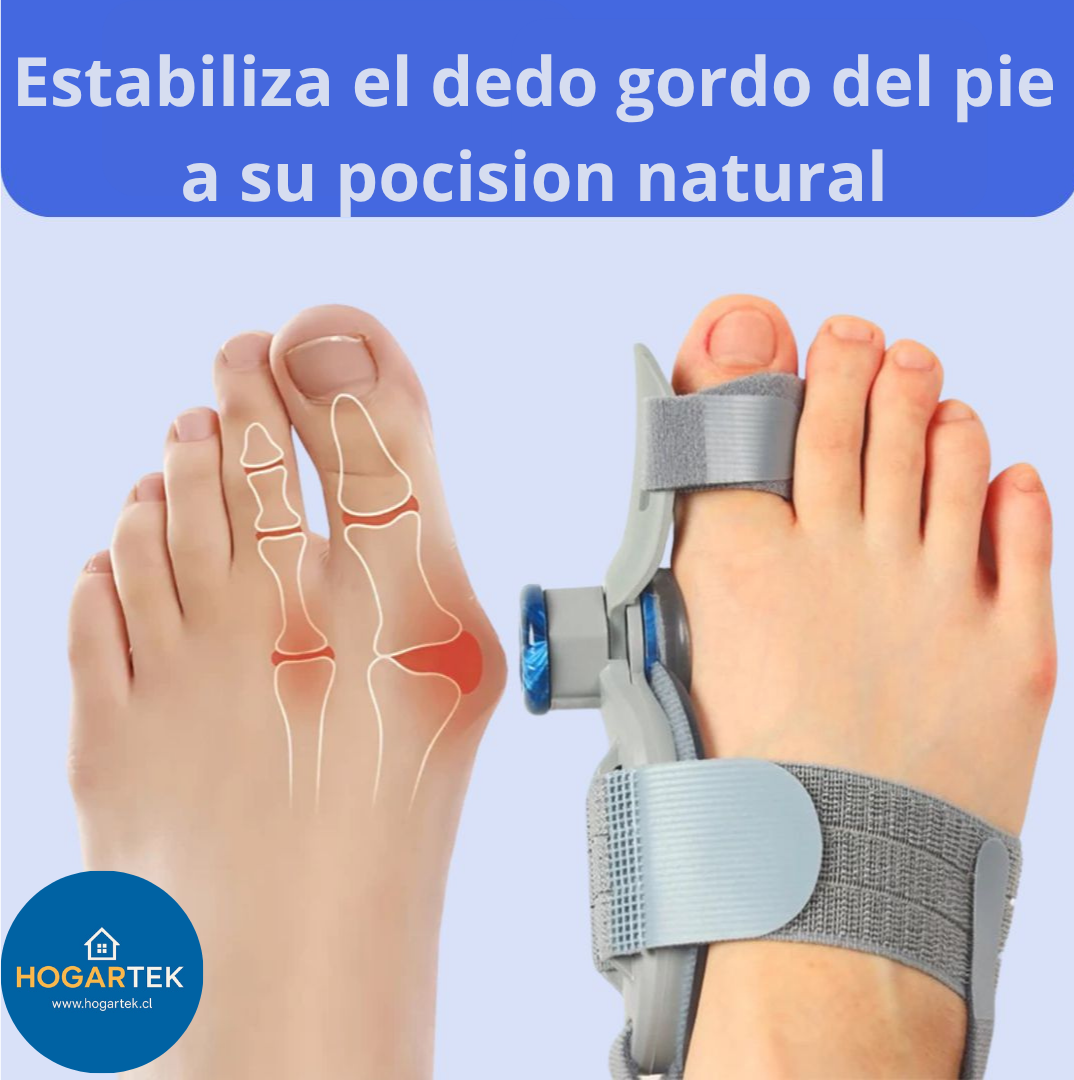Corrector Ortopédico Nocturno - Corrección suave y fija con velcro - Alivio del dolor y avance gradual en 4 semanas