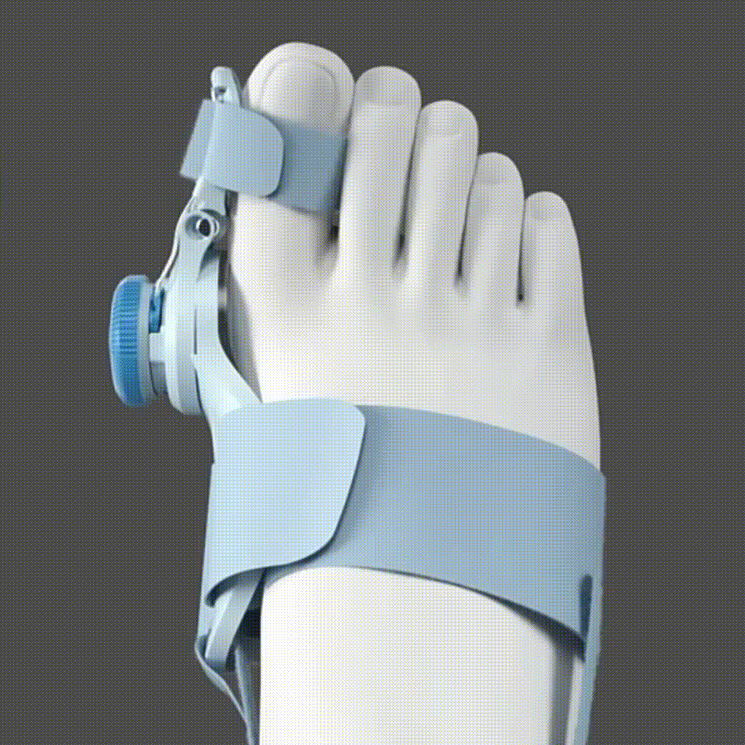 Corrector Ortopédico Nocturno - Corrección suave y fija con velcro - Alivio del dolor y avance gradual en 4 semanas